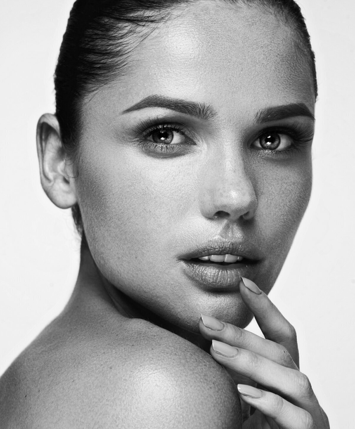 Otoplasty Image