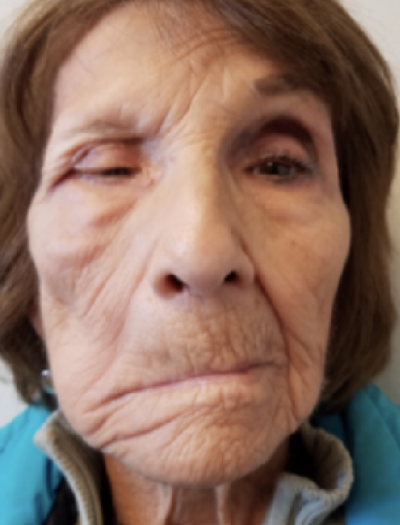 Facial Reconstruction 1 Before Image